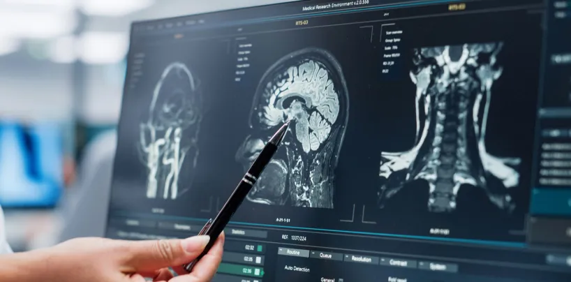 Traumatic brain injury in Los Angeles